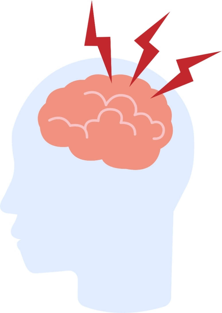 Illustration of a head and brain with red pain signals representing migraine triggers and increased brain sensitivity.