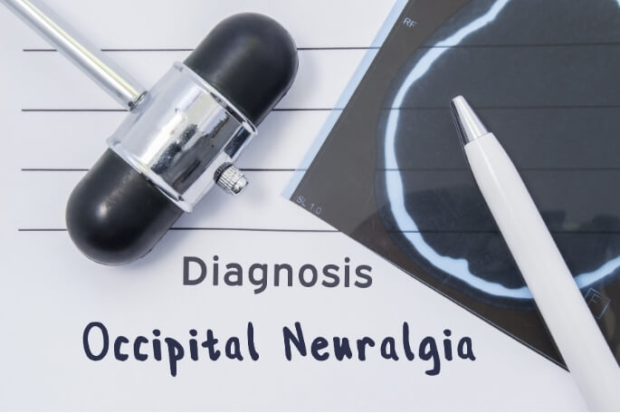 Flat lay of a reflex hammer, brain scan, and pen with the text “Diagnosis: Occipital Neuralgia,” symbolising medical assessment and diagnosis.