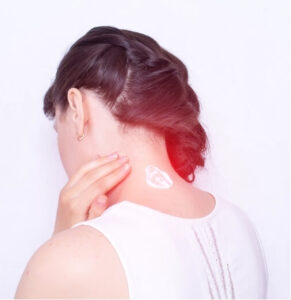 Woman with braided hair pressing the back of her neck, indicating pain in the occipital region—commonly associated with occipital neuralgia.